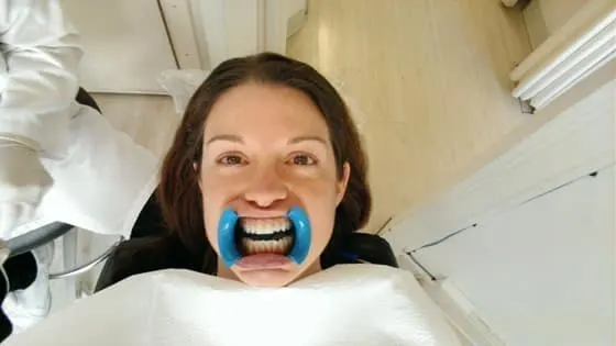 Getting my Invisalign attachments Getting my Invisalign attachments