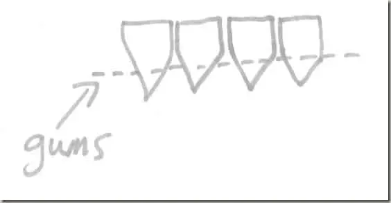 Invisalign and older teeth Invisalign and older teeth